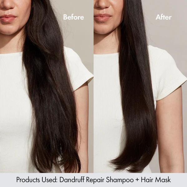 BONDI BOOST Dandruff Repair Hair Mask