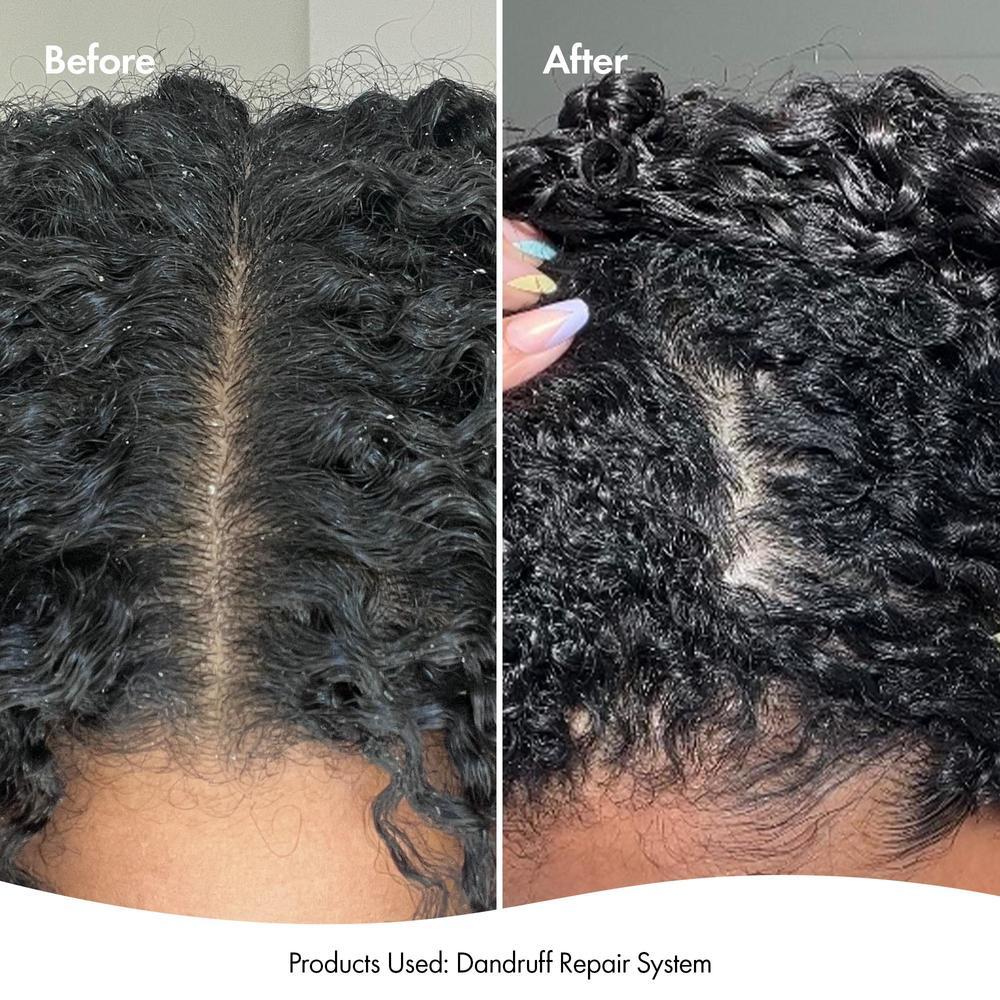 BONDI BOOST DANDRUFF REPAIR LEAVE IN SCALP SERUM 125ML