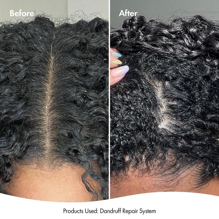 BONDI BOOST DANDRUFF REPAIR LEAVE IN SCALP SERUM 125ML
